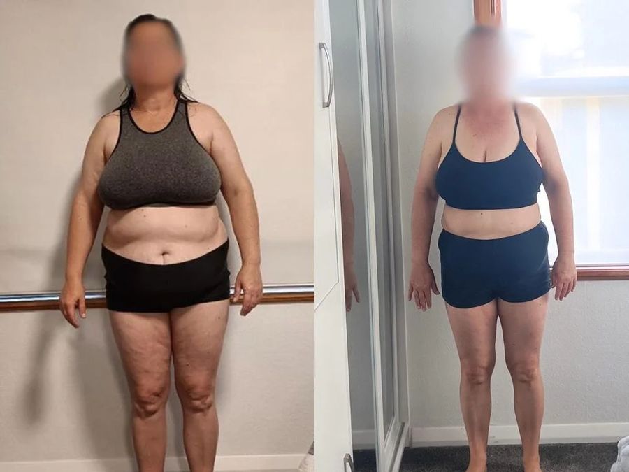 Client before and after