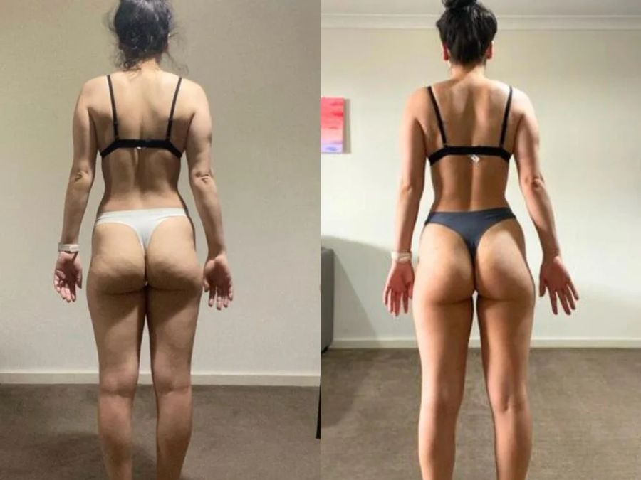 Client before and after
