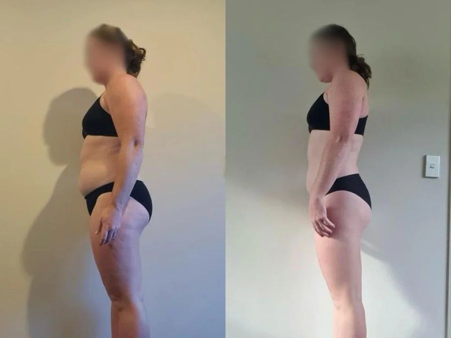 Client before and after